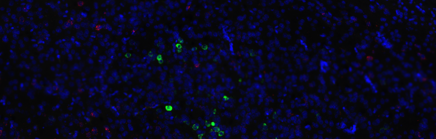 A picture of the amygdala processed to show CRF in green and c-fos in red.